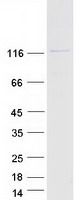 Coomassie blue staining of purified RANBP6 protein
