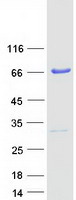 Coomassie blue staining of purified PRMT3 protein
