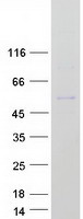 proto60806 tpit tbx19 human recombinant protein