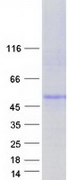 Coomassie blue staining of purified CTNS protein