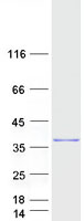 Coomassie blue staining of purified HSF2BP protein