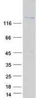 Coomassie blue staining of purified DENND4B protein