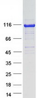 proto75146 hip1r human recombinant protein