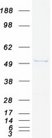 Coomassie blue staining of purified VPS4B protein