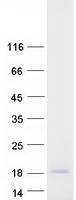 proto75380 ndufs6 human recombinant protein