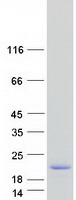 proto75409 cxorf27 hypm human recombinant protein