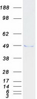 Coomassie blue staining of purified TADA3 protein