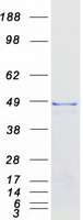 Coomassie blue staining of purified USP2 protein
