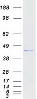 Coomassie blue staining of purified TRMU protein