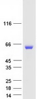 Coomassie blue staining of purified PPM1B protein