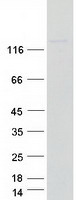 Coomassie blue staining of purified NUP155 protein