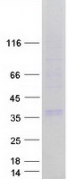 proto75712 gjb3 human recombinant protein