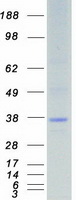 Coomassie blue staining of purified STK16 protein