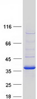Coomassie blue staining of purified CBR3 protein