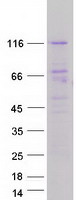 proto75912 dgki human recombinant protein