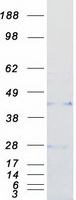 Coomassie blue staining of purified CCN5 protein