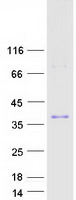 proto76080 zfand5 human recombinant protein