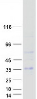Coomassie blue staining of purified RGS20 protein