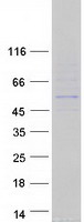proto94810 rgs11 human recombinant protein