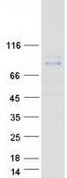 proto94844 rhobtb1 human recombinant protein