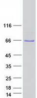 Coomassie blue staining of purified UBXN7 protein