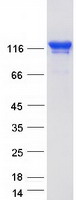 Coomassie blue staining of purified TJP3 protein