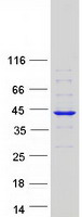 Coomassie blue staining of purified ZWINT protein