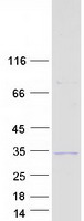 Coomassie blue staining of purified SOX14 protein