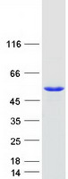 Coomassie blue staining of purified TDP2 protein