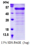 3ug by SDS-PAGE under reducing condition and visualized by coomassie blue stain.