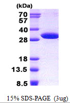 3ug by SDS-PAGE under reducing condition and visualized by coomassie blue stain.
