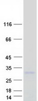 Coomassie blue staining of purified TSPAN13 protein