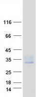 proto95858 tspan15 human recombinant protein