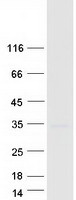 proto95859 tspan12 human recombinant protein