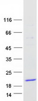 Coomassie blue staining of purified TCL1B protein