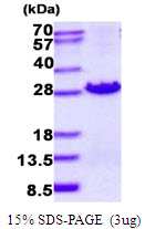 3ug by SDS-PAGE under reducing condition and visualized by coomassie blue stain