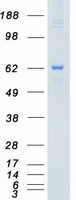 Coomassie blue staining of purified PAK4 protein