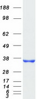 Coomassie blue staining of purified CYB5R3 protein