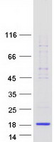 protp00709 alpha lactalbumin lalba human recombinant protein