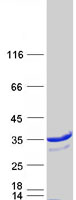 Coomassie blue staining of purified CA2 protein