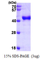 3ug by SDS-PAGE under reducing condition and visualized by coomassie blue stain