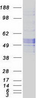 Coomassie blue staining of purified SERPINC1 protein