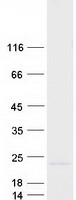 Coomassie blue staining of purified IFNA2 protein
