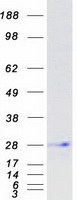 protp01591 igj jchain human recombinant protein