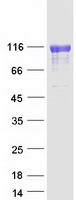 protp01833 pigr human recombinant protein