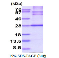 3ug by SDS-PAGE under reducing condition and visualized by coomassie blue stain