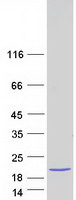 protp02144 myoglobin mb human recombinant protein