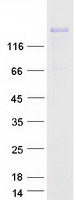 Coomassie blue staining of purified COL3A1 protein