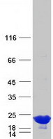 Coomassie blue staining of purified CRYAA protein