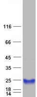 Coomassie blue staining of purified RBP4 protein
